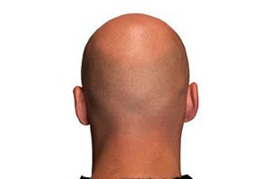 Èëëþñòðàöèÿ ê êîììåíòàðèþ
