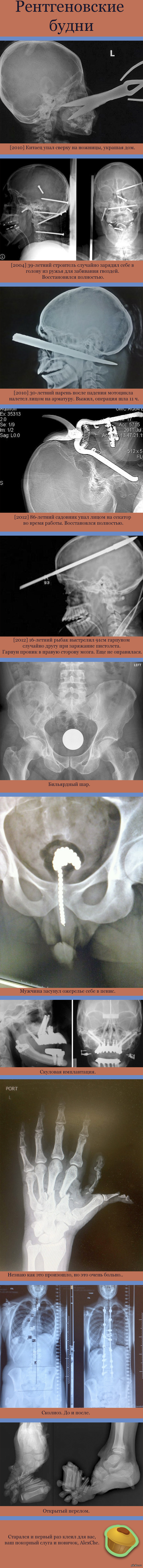 Рентгеновские будни(Длиннопост) | Пикабу