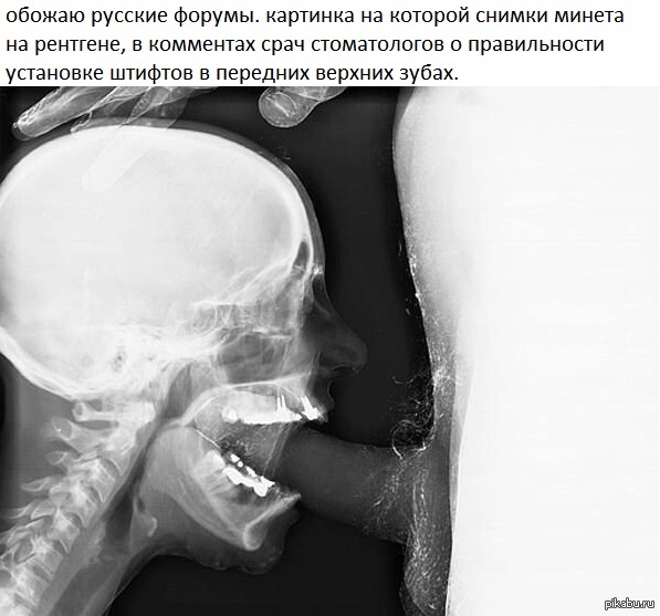 x-ray - NSFW, X-ray, Russians