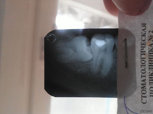 ��� �������� �������!