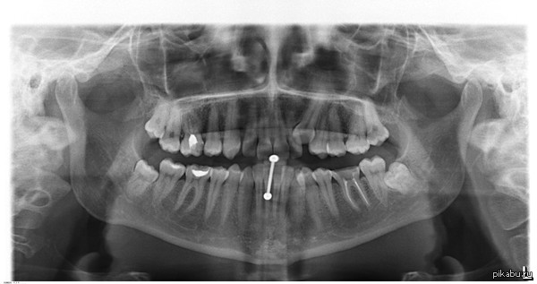 ��� � �������� ��������� ���� �������. ������.