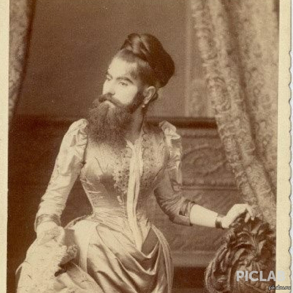 Анна Джонс, известная как Бородатая женщина