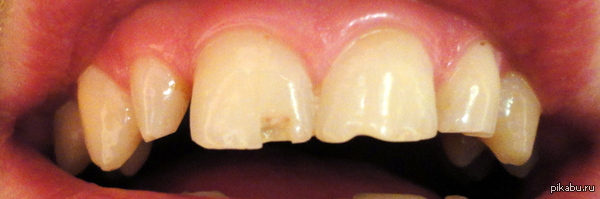 FuckFuckFuckFuuuck!!!!