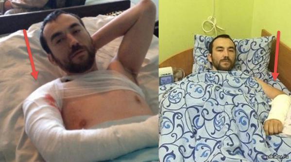 "Блуждающие" раны у разведчика ГРУ.