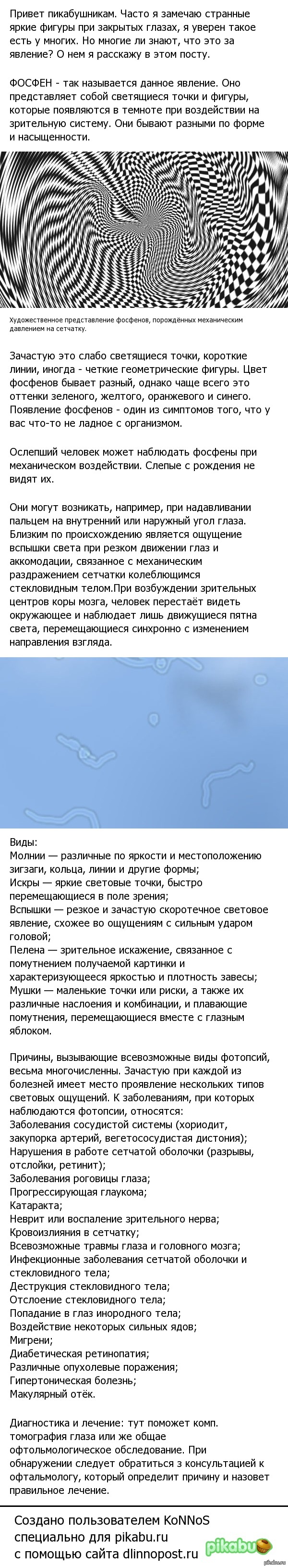 фосфены что это такое простыми словами. Смотреть фото фосфены что это такое простыми словами. Смотреть картинку фосфены что это такое простыми словами. Картинка про фосфены что это такое простыми словами. Фото фосфены что это такое простыми словами