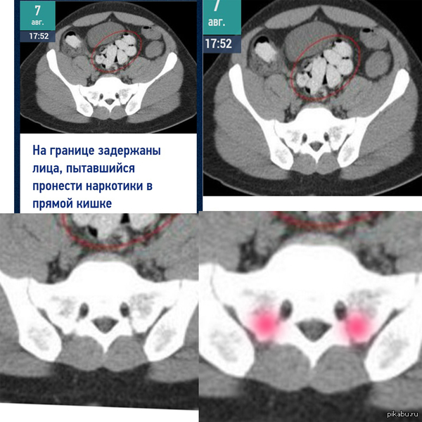 ����� �������.