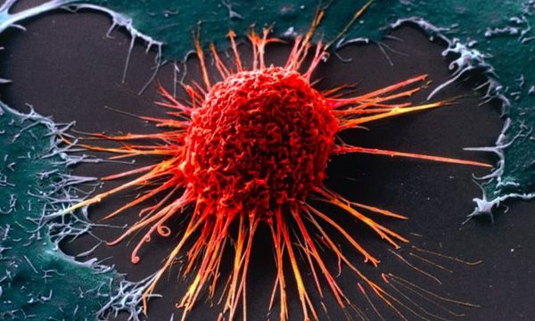 NEW TEST TO DETECT CANCER 10 YEARS BEFORE ITS APPEARANCE - The medicine, 