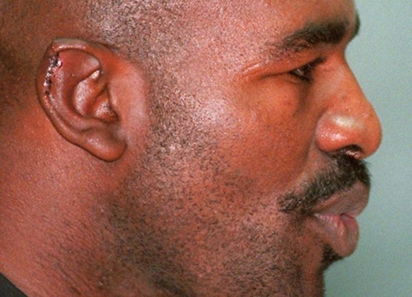 20 years without an ear. Anniversary of the most scandalous boxing fight - Mike Tyson, Evander Holyfield, Ears, Boxing, Anniversary, Video, Longpost