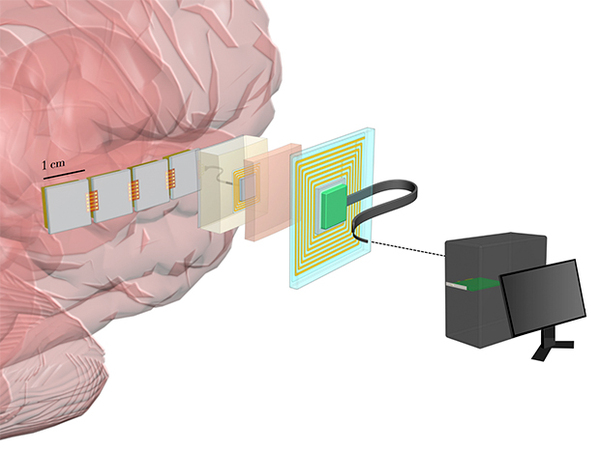 DARPA commissioned the development of high-resolution brain implants for the brain-computer interface - Technologies, Longpost, Neural Interface, Darpa, Geektimes