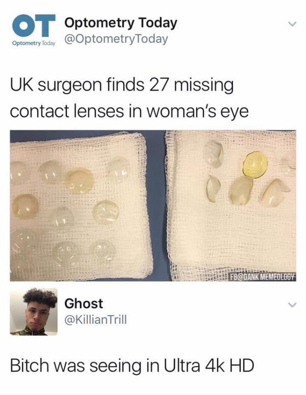 Update British pensioner forgot 27 lenses in her eye - Lenses, Comments, The photo