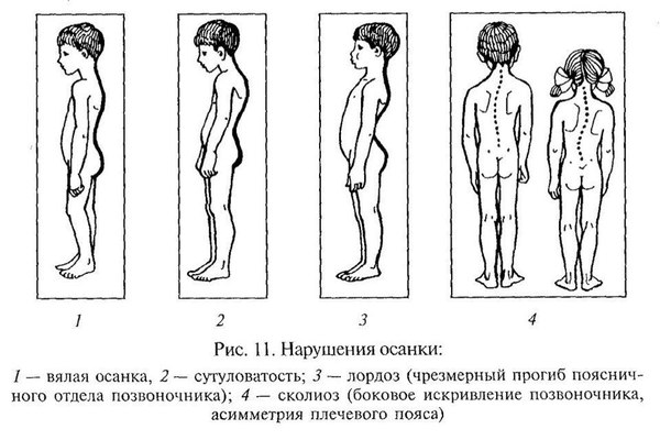 Как избавиться от привычки сутулиться - Спорт, Тренер, Программа тренировок, Здоровье, Фитнес, Осанка, Спортивные советы, Длиннопост