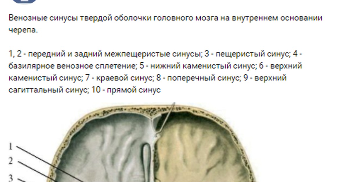 Синусы оболочки головного мозга. Синусы твердой мозговой оболочки. Каменистые синусы головного мозга. Верхний Сагиттальный синус головного мозга. Синусы твердой мозговой оболочки схема.