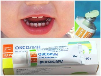 Matured - Growing up, Oxoline ointment, , Childhood memories