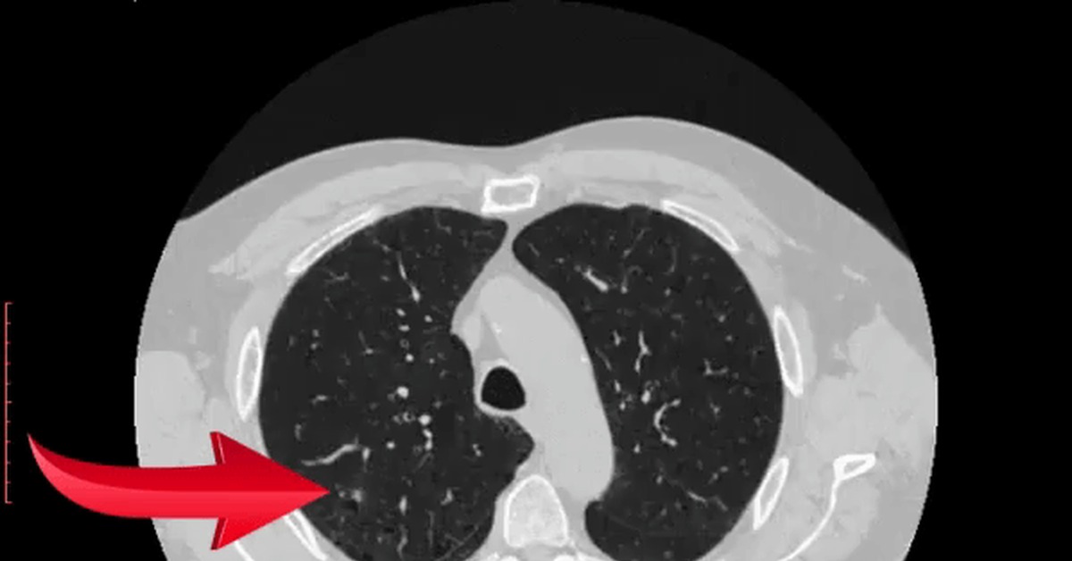 Але кт. Компьютерная томография gif. Компьютерная томография анимация. Кт гифка.