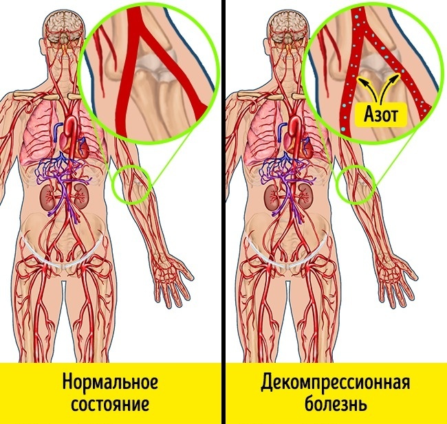 The reaction of our body in extreme situations - A selection, Longpost, Person, Health, Body, Interesting, Not mine, ADME