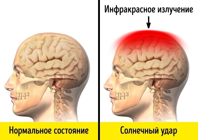 The reaction of our body in extreme situations - A selection, Longpost, Person, Health, Body, Interesting, Not mine, ADME