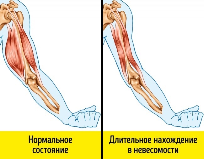 The reaction of our body in extreme situations - A selection, Longpost, Person, Health, Body, Interesting, Not mine, ADME