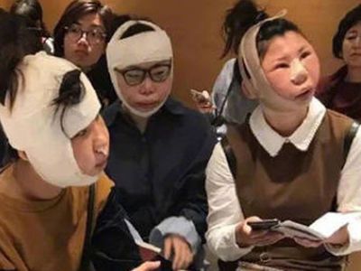 Chinese women were unable to return to the country after plastic surgery due to swollen faces - Chinese, South Korea, Plastic surgery