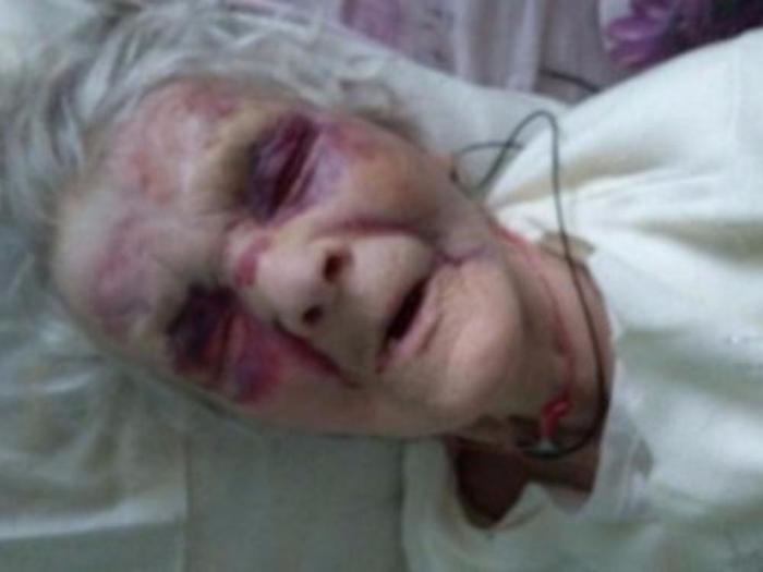 Grandma fell... - Death, The medicine, Medicine in Russia, Longpost