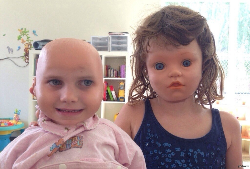2 ребенок с огромным. Кукольное лицо у ребенка. Кукольное лицо болезнь.
