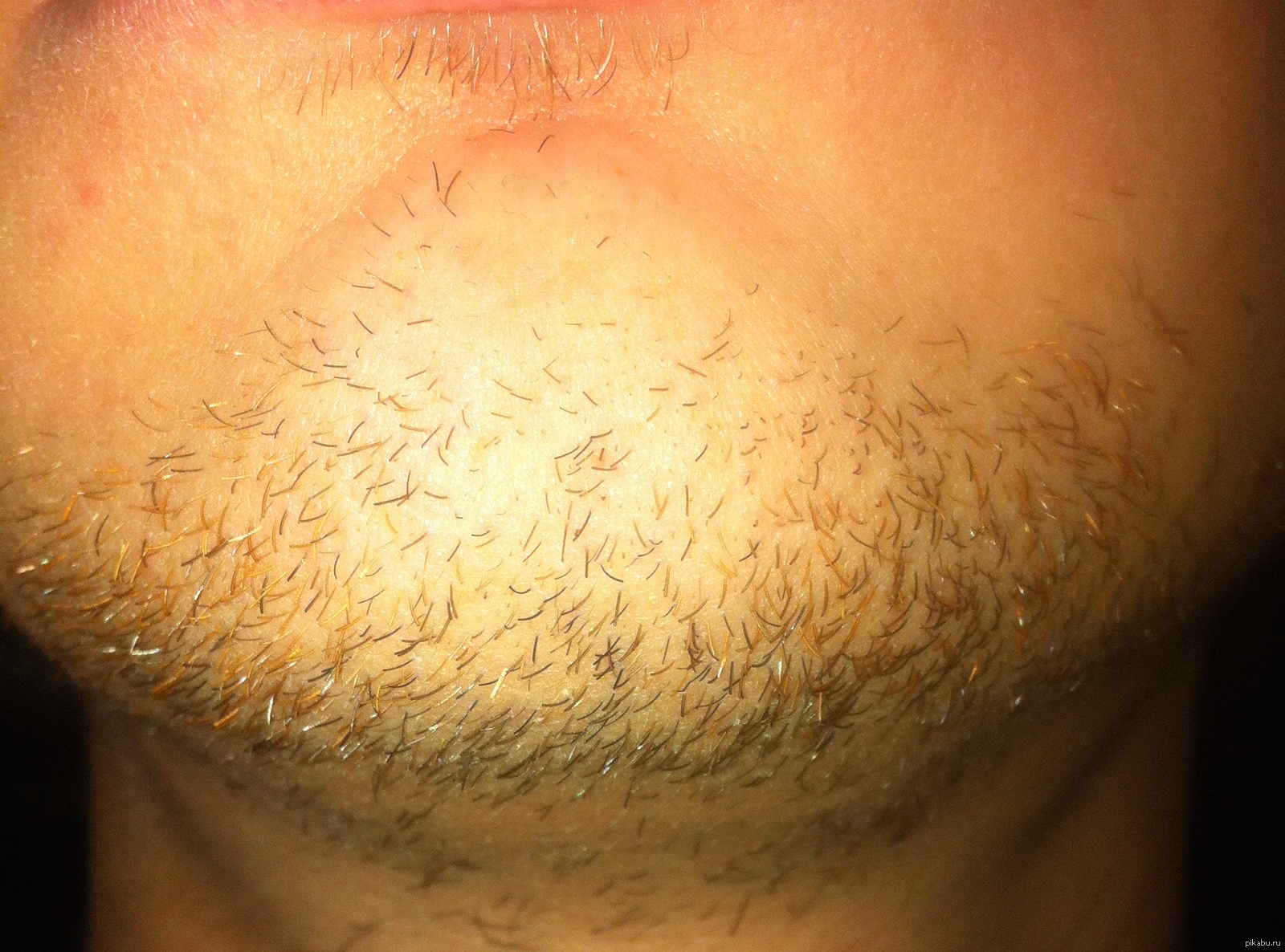 Почему быстро растут волосы на лице у мужчин после бритья