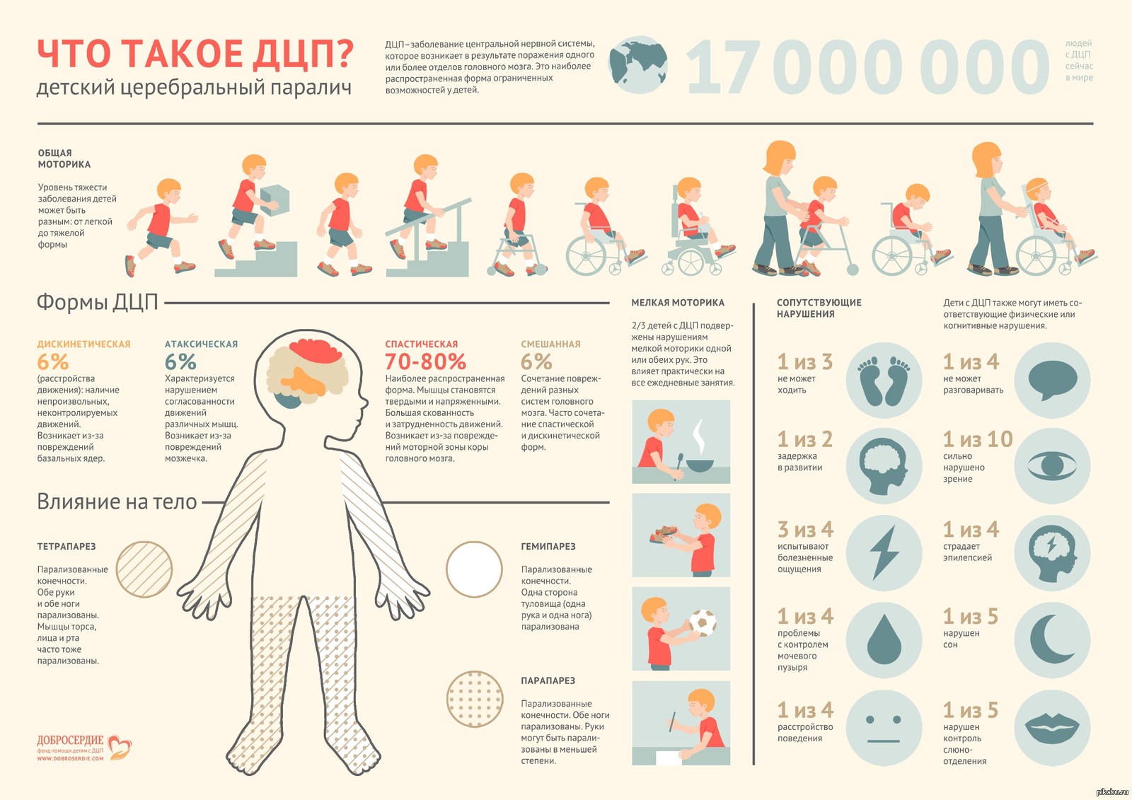 Сколько больных детей. ДЦП легкая форма симптомы. ДЦП симптомы у грудничков. Лёгкая форма ДЦП признаки у детей. Как распознать ДЦП У грудничка в 6 месяцев.