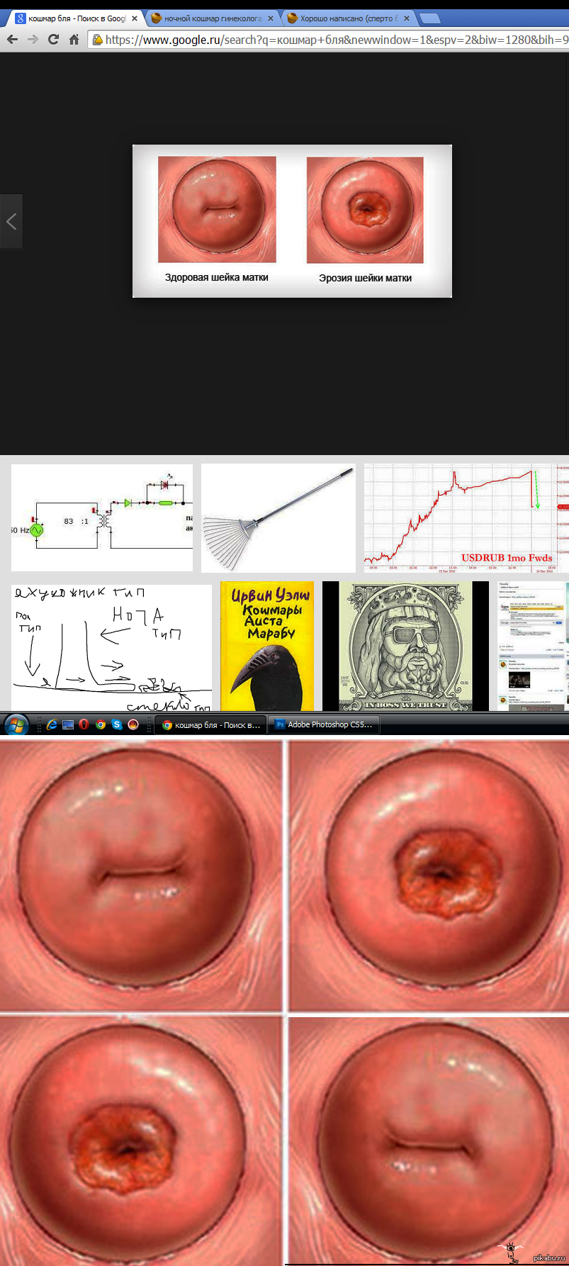 эрозия матки и оргазм фото 35