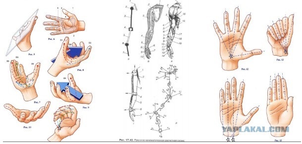 The story of the titanium hand - My, Prosthesis, Diploma, Uhf SR, Longpost