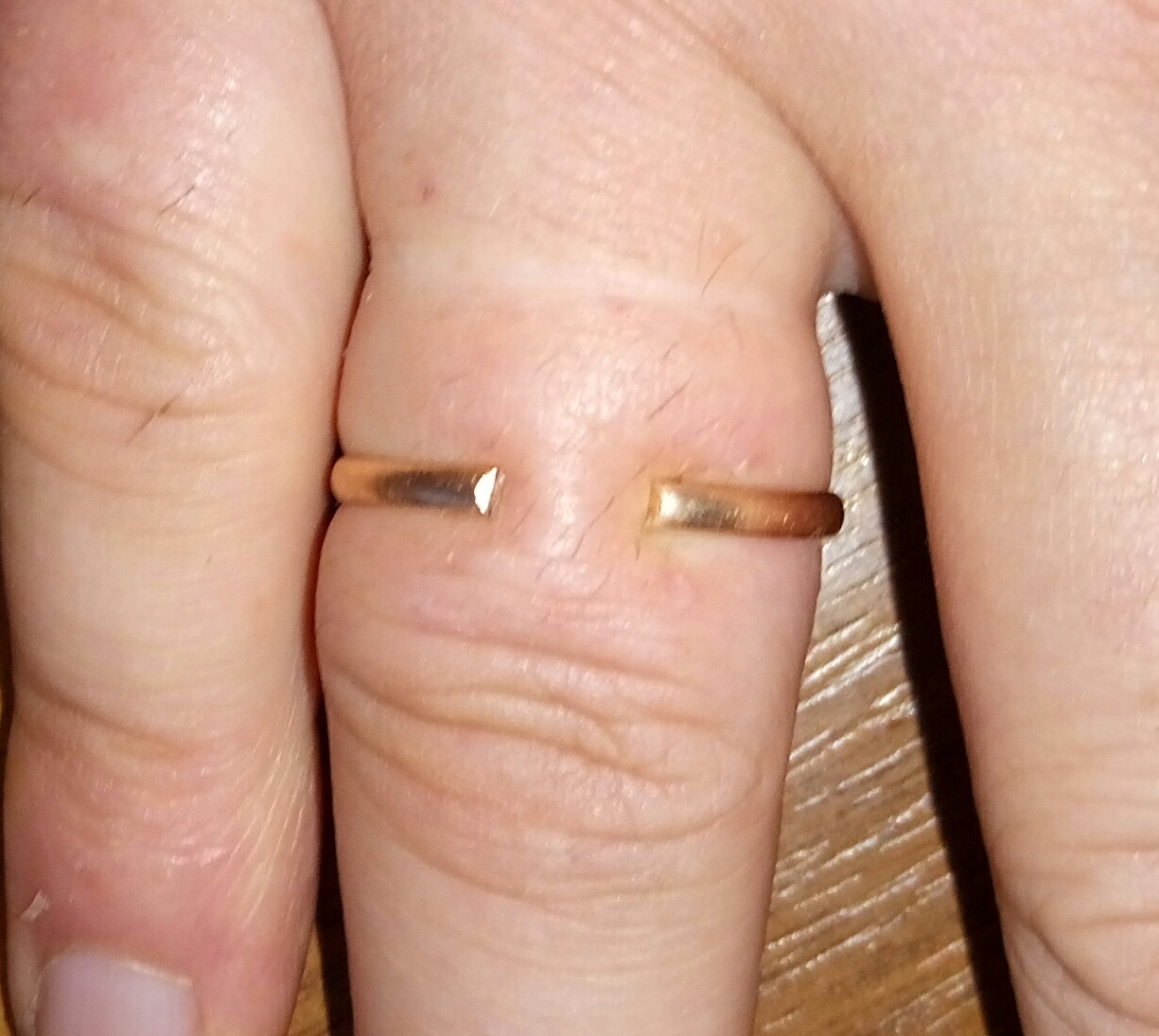 Ring. - My, Wedding ring, Problem