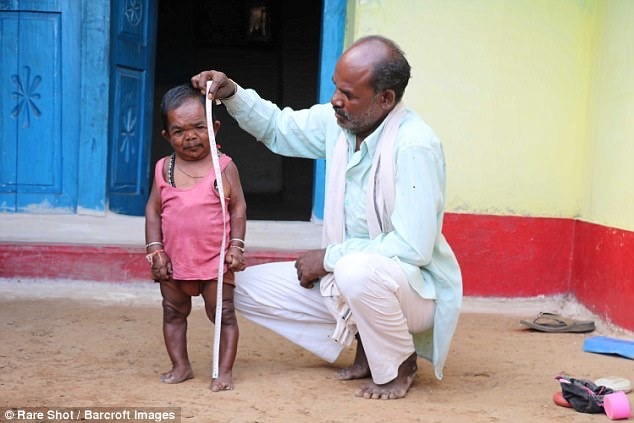 50 year old Indian thumb boy - India, , Oddities, Interesting, Longpost