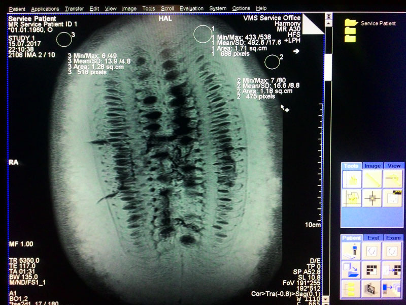 How to determine the ripeness of a watermelon? - Watermelon, MRI, Summer is coming, Geektimes