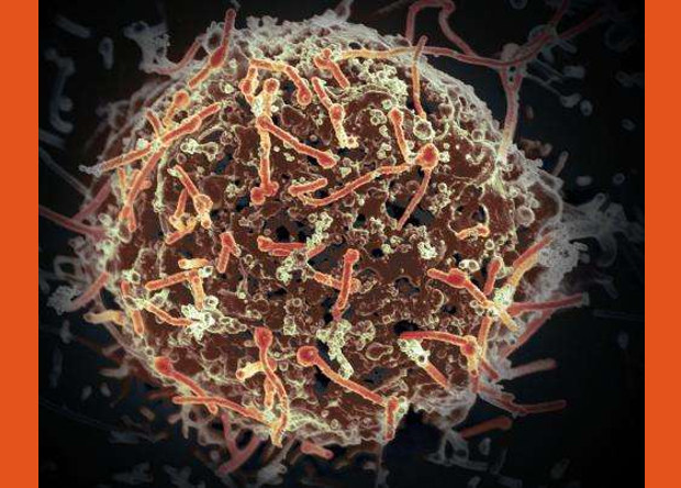 Ebola virus persists in men's semen two years after recovery - The science, news, The medicine, Virus, Ebola