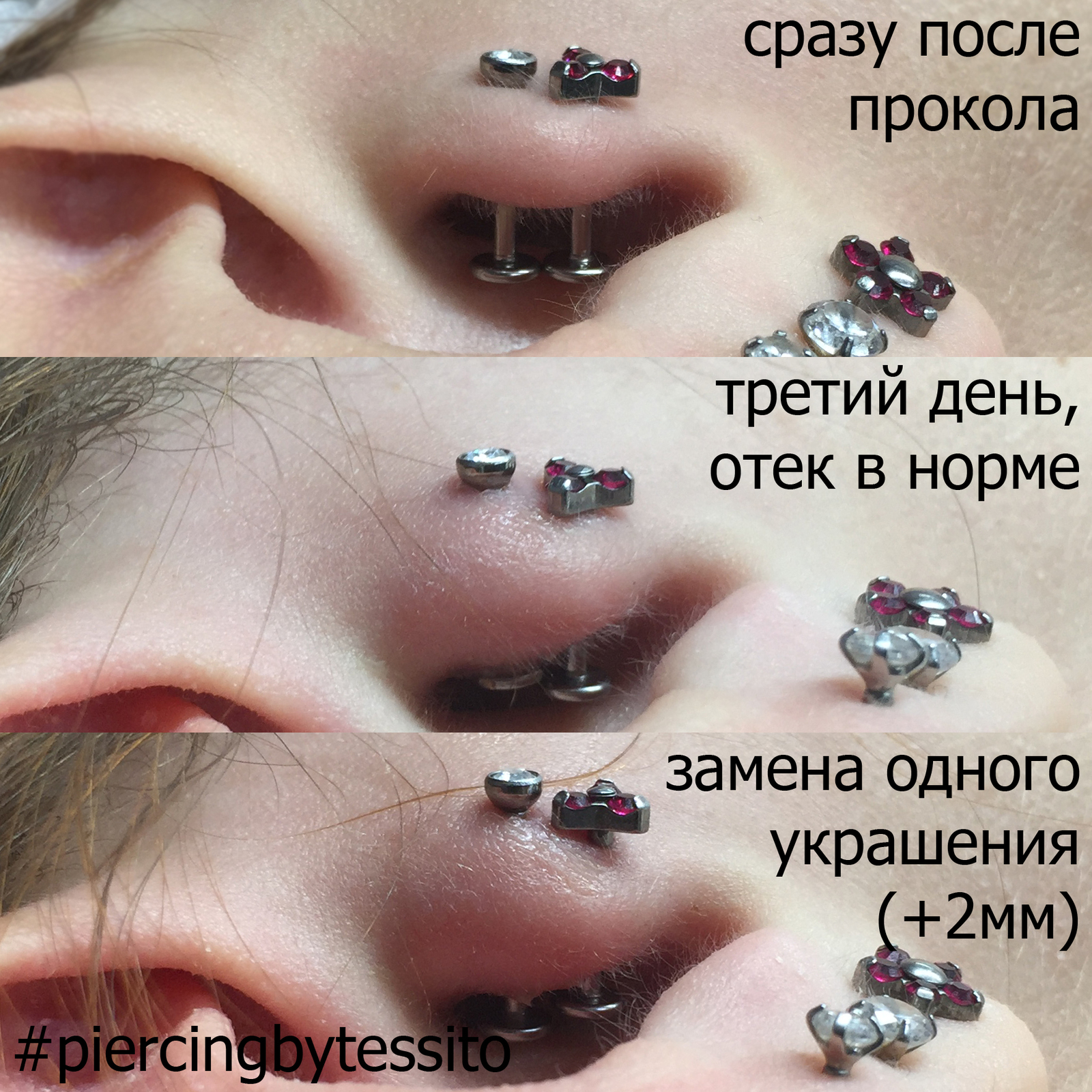 Козелок Уха Labret пирсинг губ Titanium16g 6-10 мм