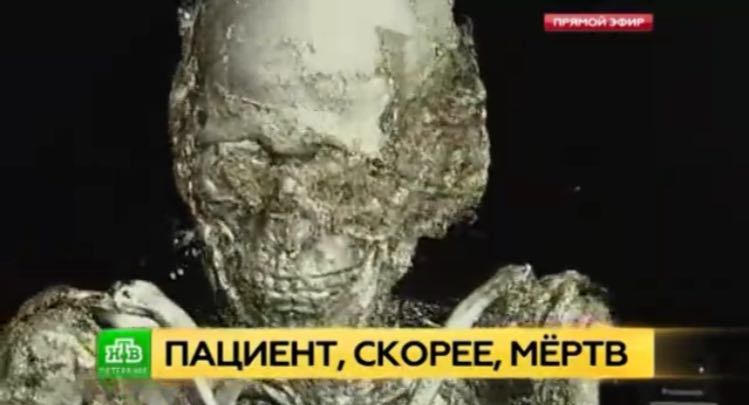 Mummy smile on CT - Mummy, NTV, Rustograph, Rustomograf, CT, Tomography, Saint Petersburg, Story, Video, GIF